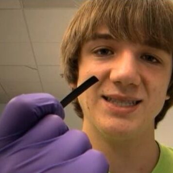 Jack-Andraka